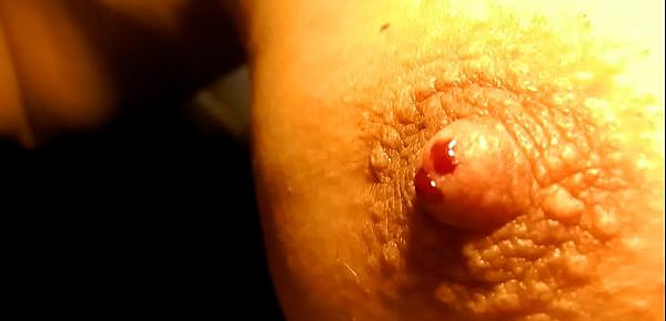  little needles pulling out from nipple